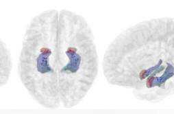 科学家发现大脑记忆工作原理 有助于对抗阿尔茨海默病