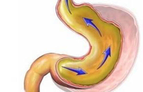 胃酸过多的症状 胃酸过多的3大表现