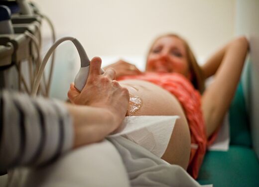 孕期B超检查你知道多少？