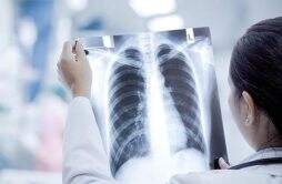 重症白肺死亡率40%以上 新冠造成白肺的概率不是很高
