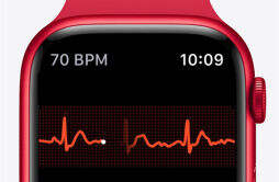 苹果 Apple Watch 新专利：引入雷达传感器，监测人体呼吸和心血管方面的生物特征