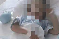5岁男童被生母虐待致截肢 妇联回应已采取帮扶措施