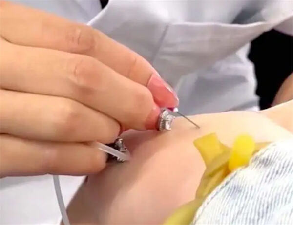 哈尔滨一医院护士戴美甲给病患扎针