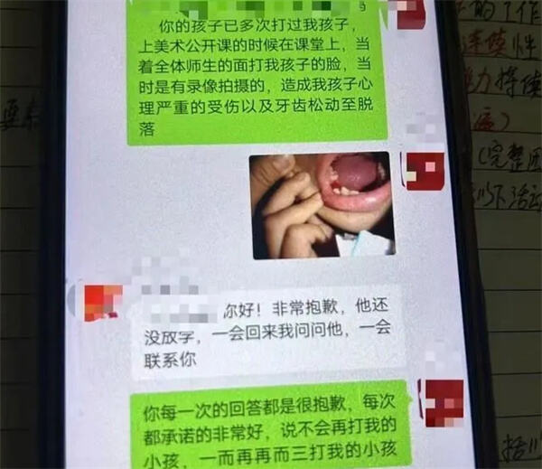 广州一小学生疑遭校园霸凌后被确诊为创伤后应激障碍