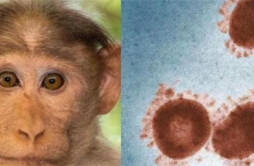 出现女性猴痘感染者意味着什么 女性猴痘感染者注意这点