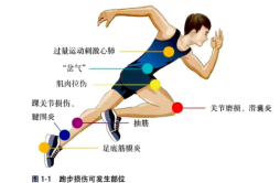 网传“越跑步，膝盖越废”，医生：跑步有益身体，跑步姿势不对会带来伤害