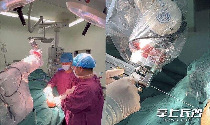 中南大学湘雅三医院功能神经外科团队的专家在为患者实施新技术的脑起搏器植入术。医院供图